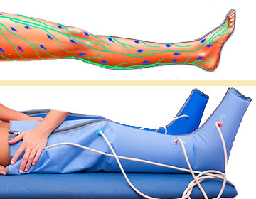 Presoterapia